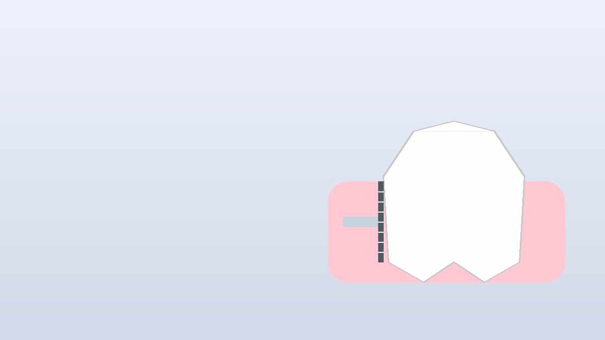 Protocolos periodontales: del diagnóstico a la reevaluación